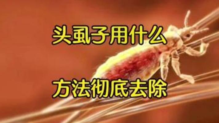 彻底摆脱虱子困扰：实用方法大揭秘