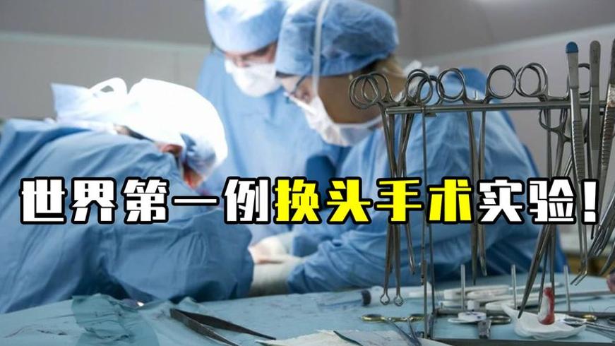5年前7000万换头手术在中国完成 如今结果如何
