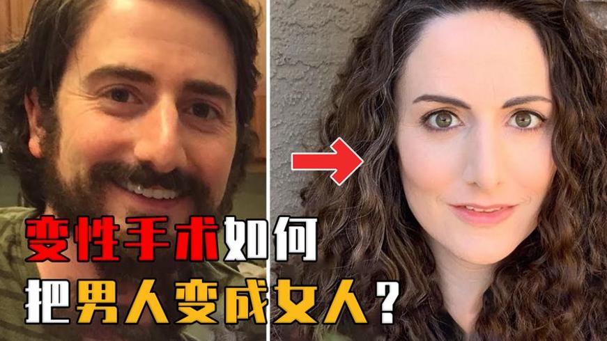 揭秘变性手术：男性变女性的艰难历程与挑战