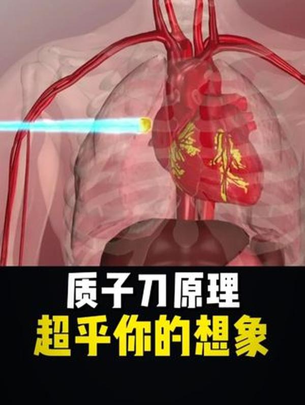 “放疗界天花板”质子刀：每分钟花费4万，它为何能精准杀灭肿瘤？