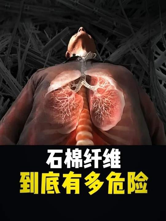 石棉瓦：潜伏的致命杀手