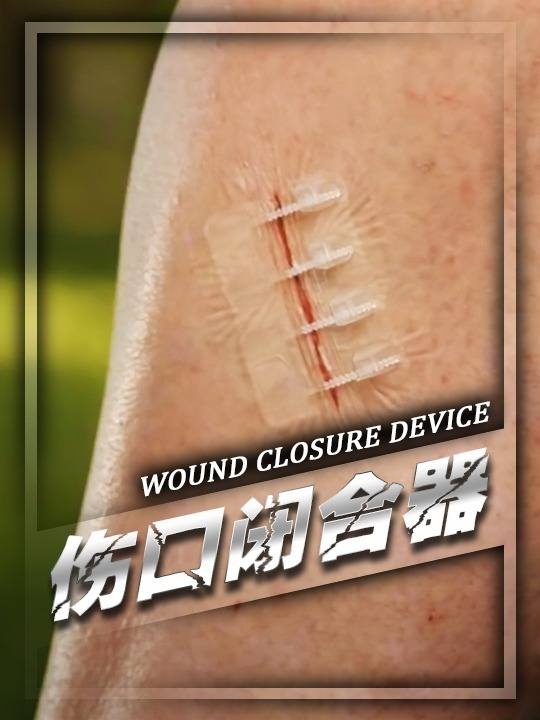 无创伤口闭合器：革新传统护理的智能创可贴