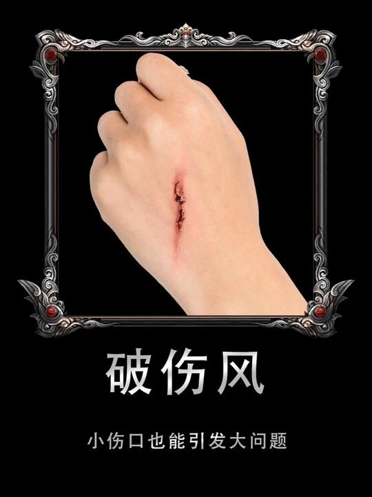 锈钉索命：破伤风暗影下的生死较量